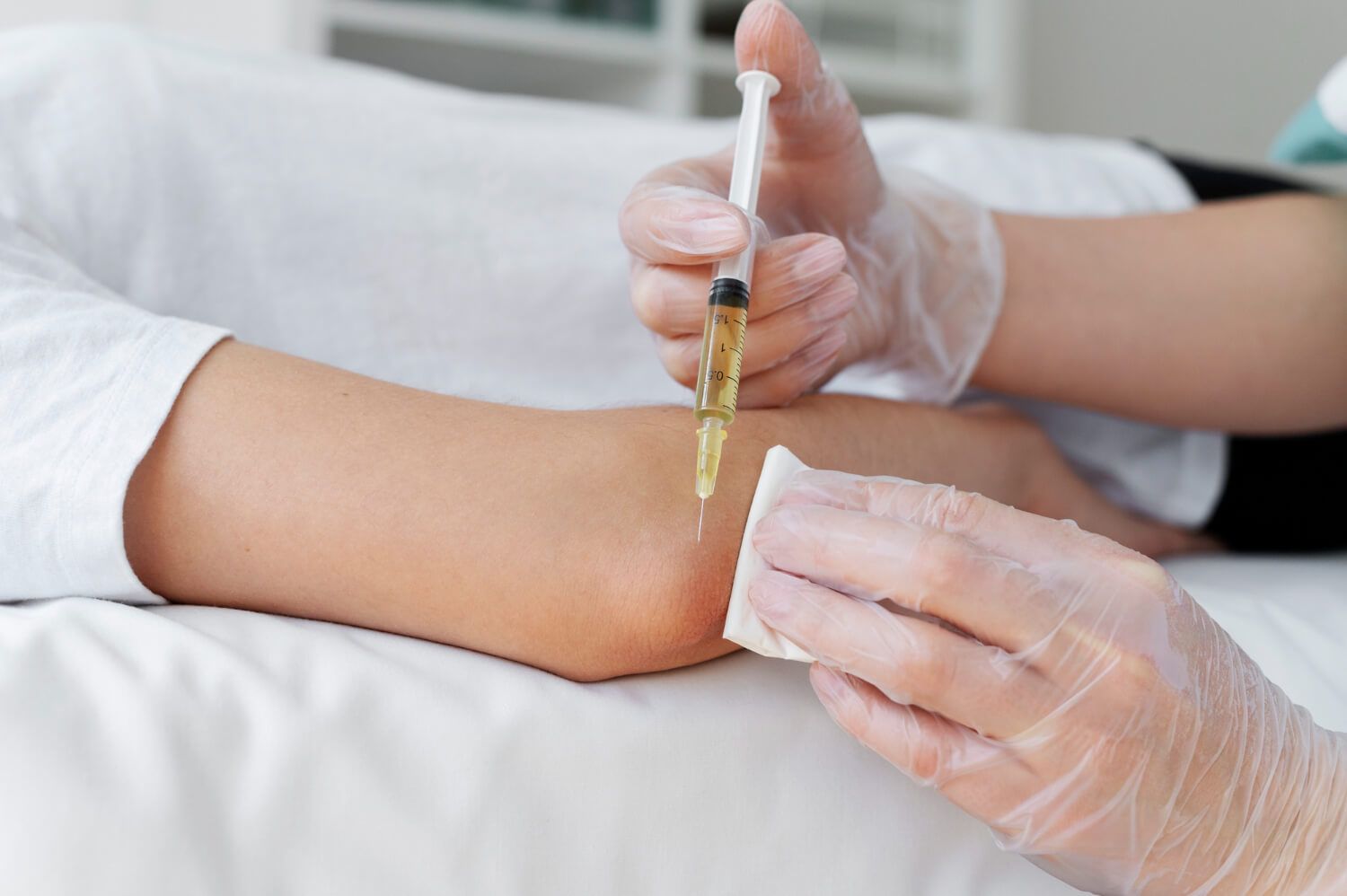 Stem Cell Therapy