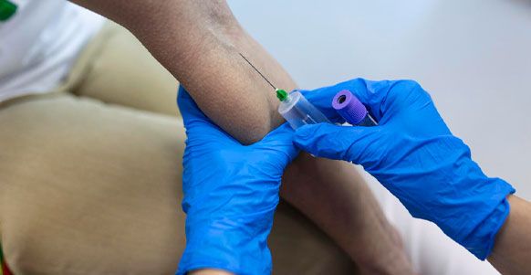 Stem-Cell-Therapy-Downers-Grove