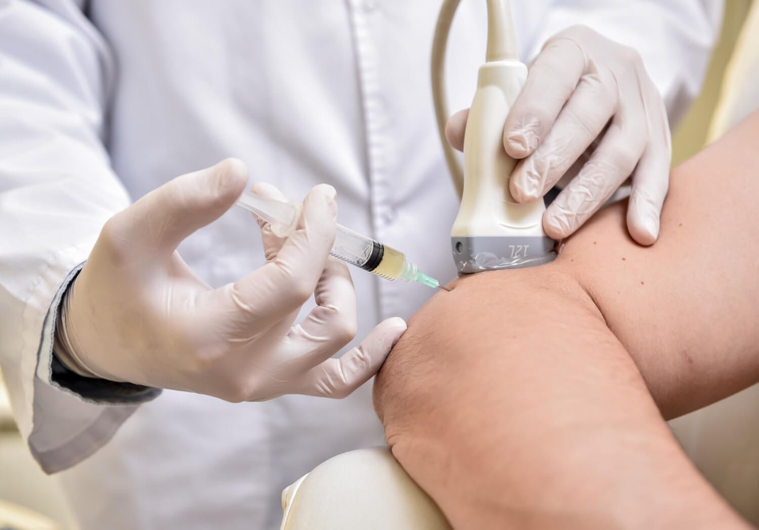 Stem Cell Therapy
