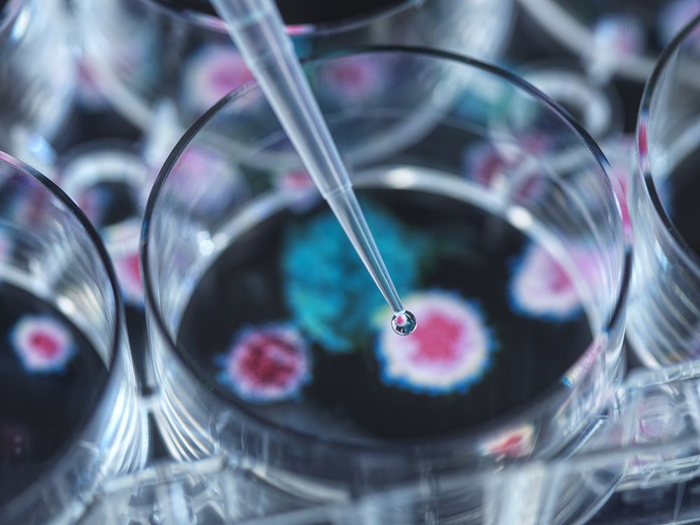 stem cells in petri dish