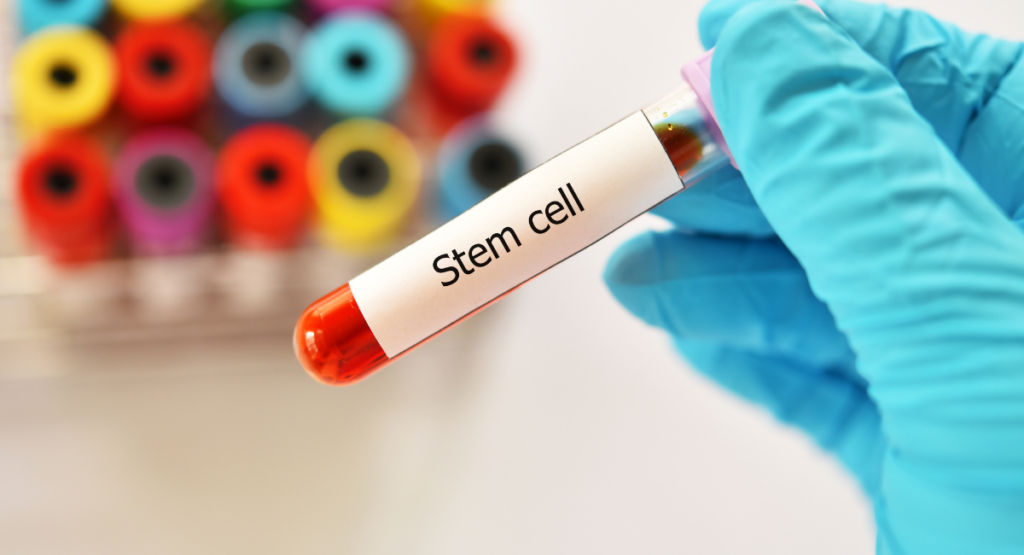 Stem Cell Therapy